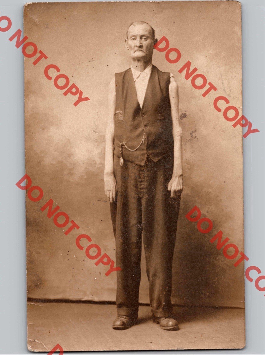 WOW c1910 Circus Sideshow Freak SKINNY ARMS Weird Body Unusual RPPC Real Photo WOW c1910 Circus Sideshow Freak SKINNY ARMS Weird Body Unusual RPPC Real Photo