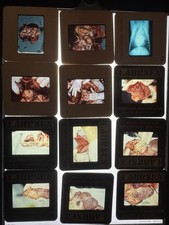 Vintage 1980s Medical Slide Film Lot ~500 slide photographs + Carousels picture